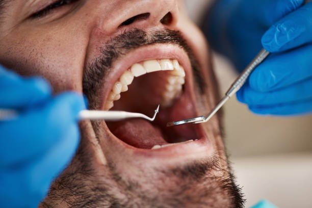 Best Pediatric Emergency Dentist in Leadwood, MO