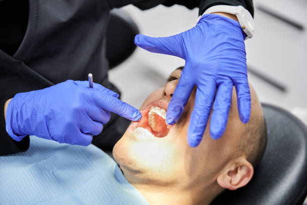 Best Emergency Dental Extractions in Leadwood, MO